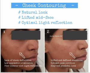 cheek contouring