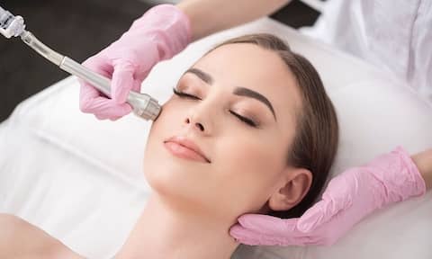 Microdermabrasion