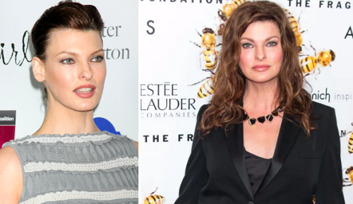 Linda Evangelista before and after cosmetic surgery