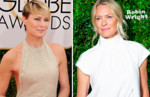 Robin Wright before and after cosmetic surgery