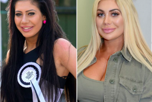 chloe ferry before and after cosmetic surgery