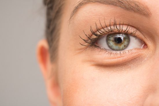 What Really Causes Puffy Eyes and Eye Bags?