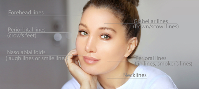 areas where botox can be injected on the face