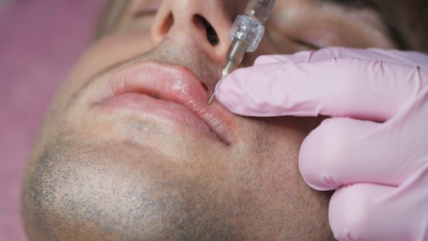 Man getting beauty injection for lips. Close-up of hands of cosmetologist making injection in male lips. Lip augmentation and correction form for man