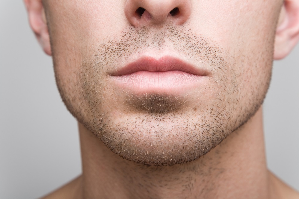 Chin Implant vs Filler Treatment For Men