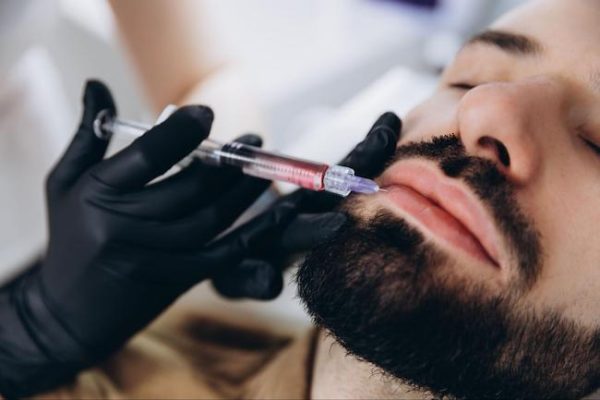 Types of Lip Fillers for Men