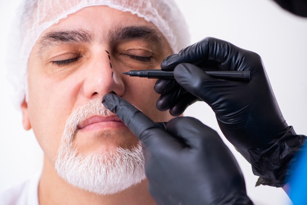 Rhinoplasty Surgery for Men 1